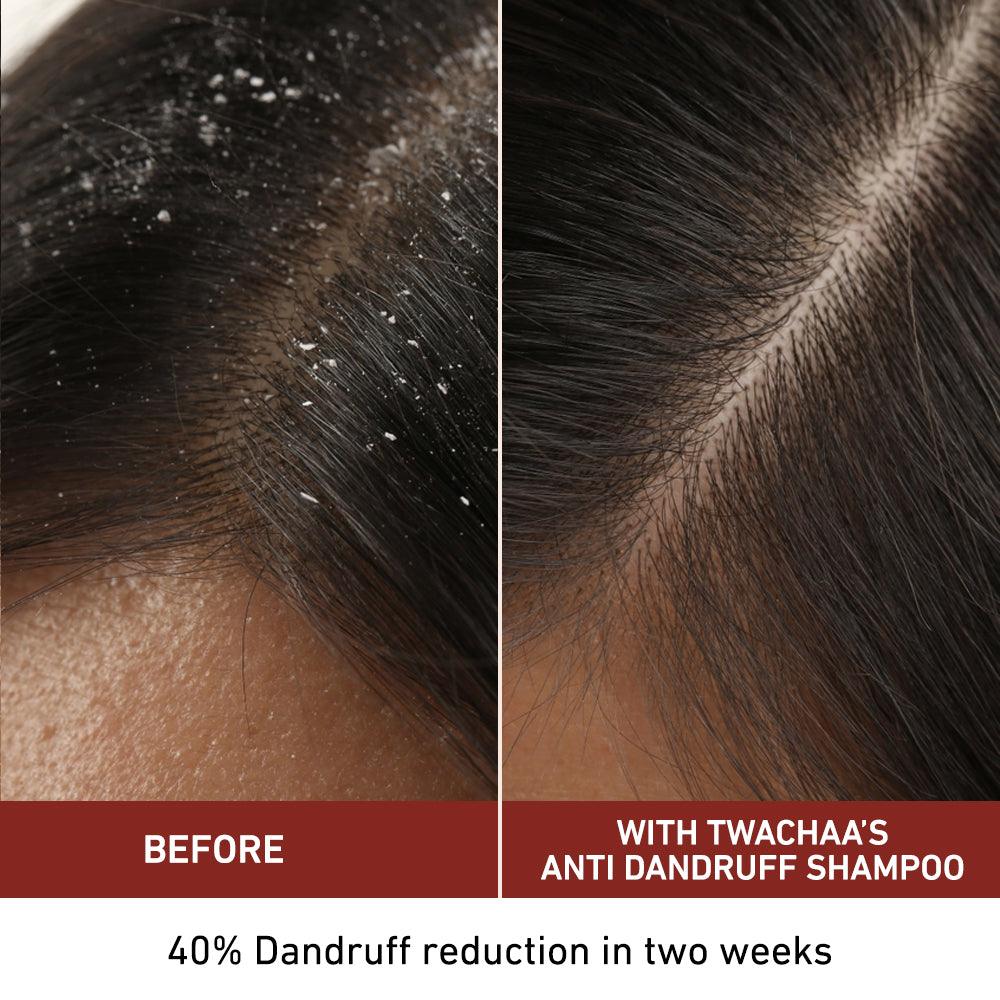 Anti-Dandruff Shampoo with Keratin and Amla for Healthy Scalp
