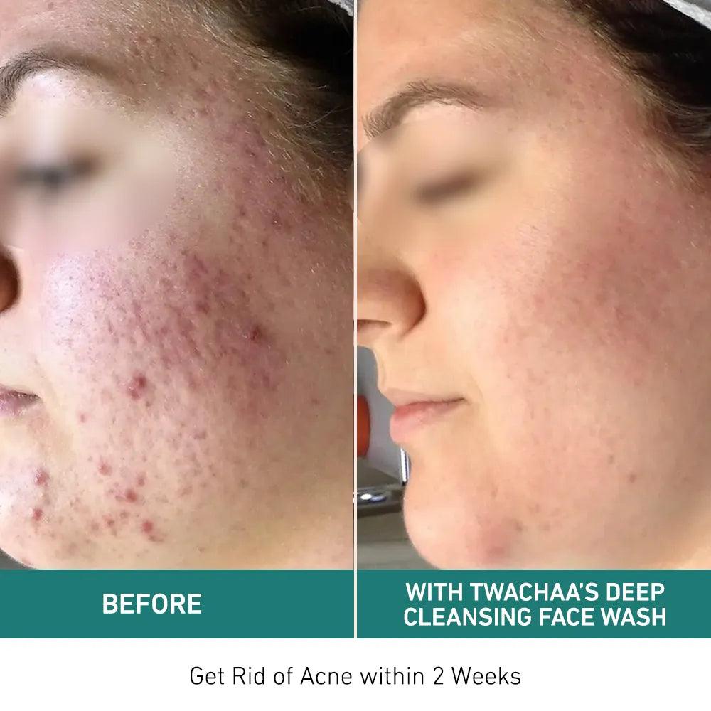 Deep Cleansing Face Wash for Exfoliation & Reducing Sebum